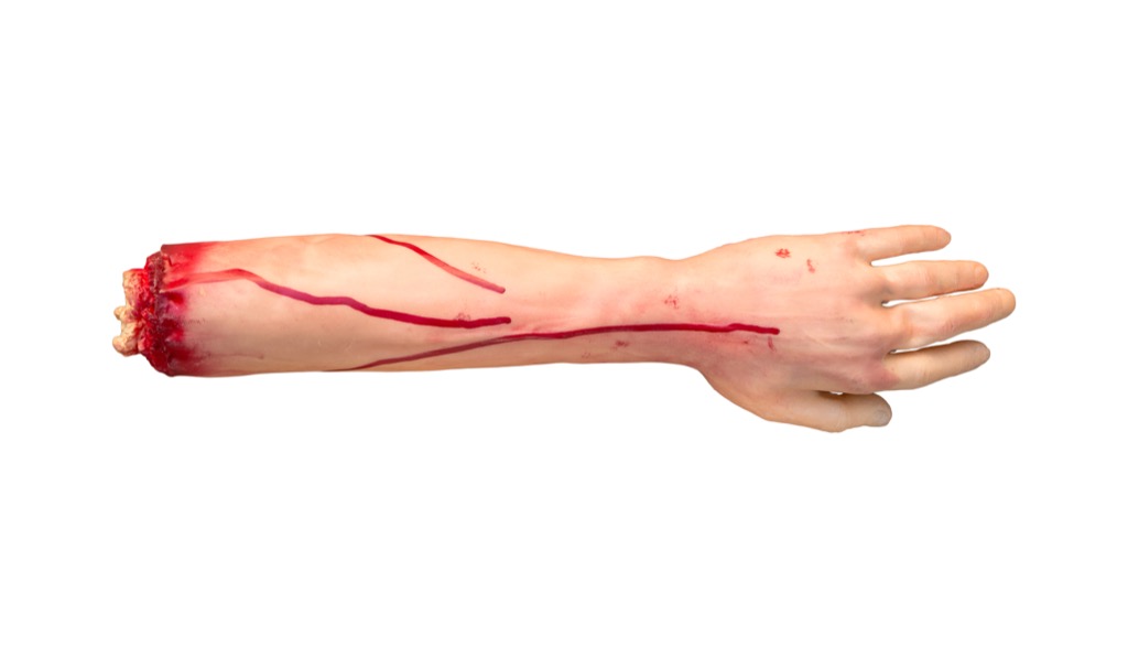 fake limb