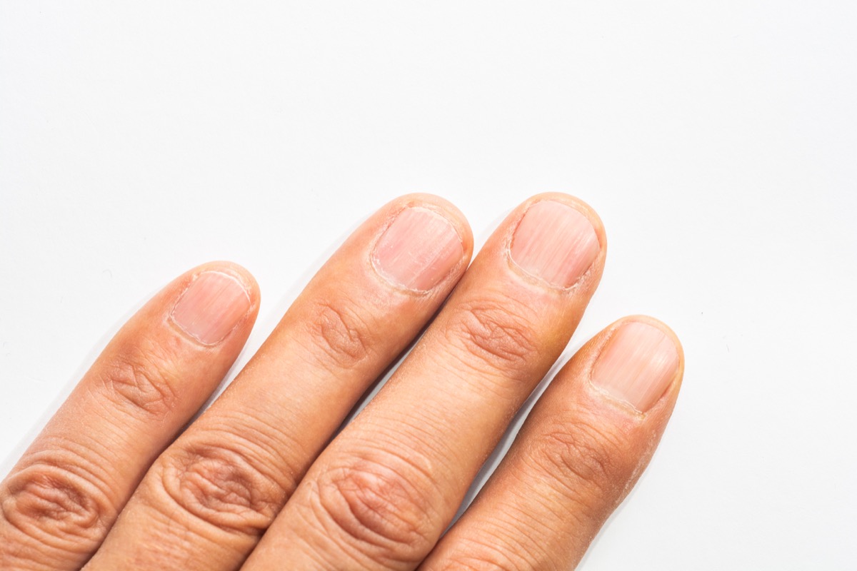 Nails with white lines