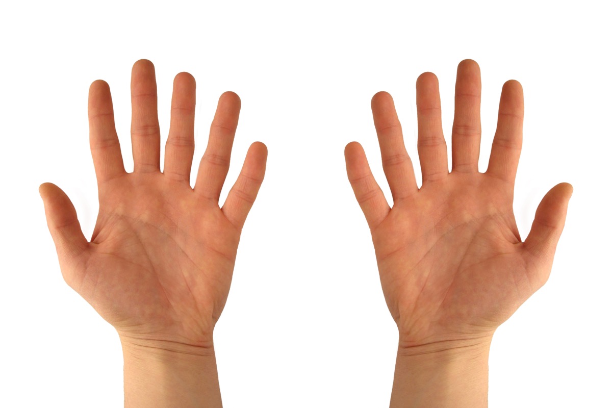 two hands with 6 fingers