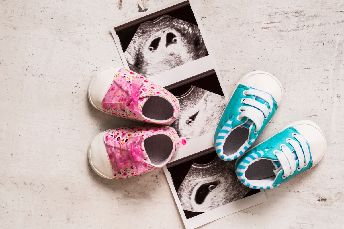 Ultrasound pics of twins and two sets of baby shoes