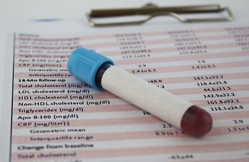 cholesterol blood test