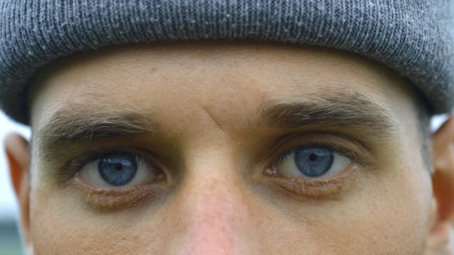 Closeup man with blue eyes and small scar