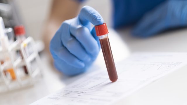 Diagnostician is doing a blood sample test.
