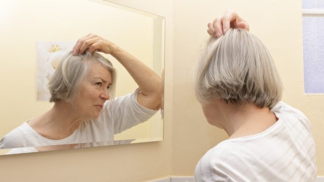 hair loss