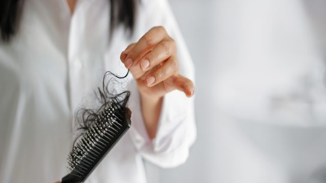 woman losing hair on hairbrush