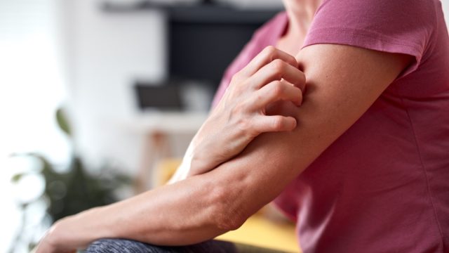 Woman with itchy, tingling arms scratching skin.