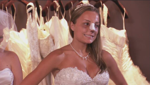 A contestant on the reality show, Bridal Plasty in a wedding dress with a cast on her nose.