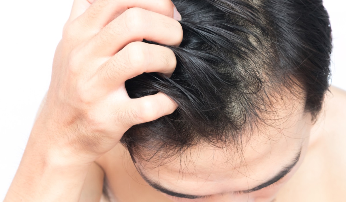 man scratching his scalp