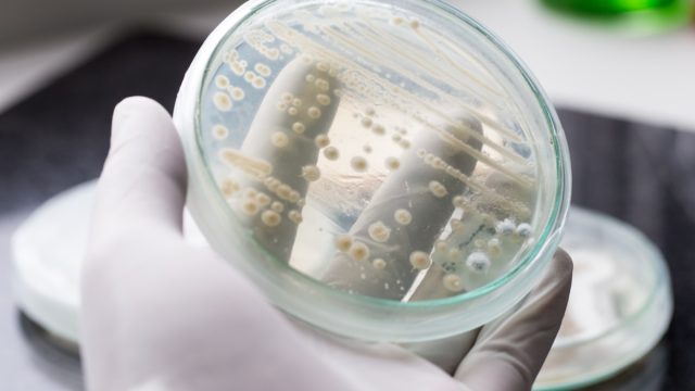 Yeast in petri dish, Microbiology for education in laboratories.