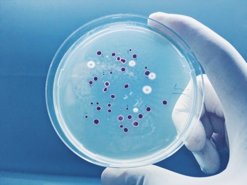 Agar plate full ofmicro bacterias and microorganisms