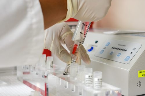 Doctor Drawing up Stem Cells into Syringe