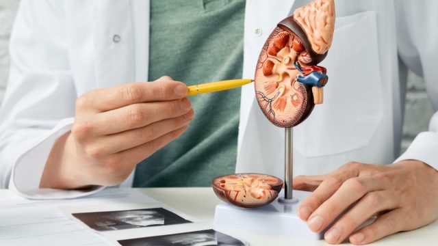 Urology and treatment of kidney disease. Doctor analyzing of patient kidney health using kidney ultrasound and anatomical model