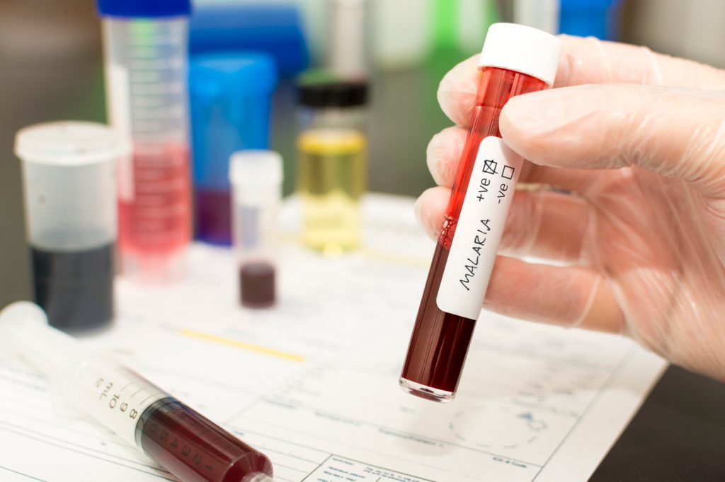 A close up of a hand holding a test tube with a blood sample that's positive for malaria
