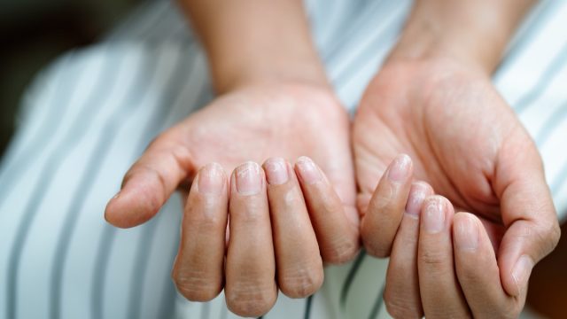 Closeup of woman looking at her finger nails