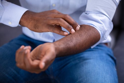 man checking for rash on arm