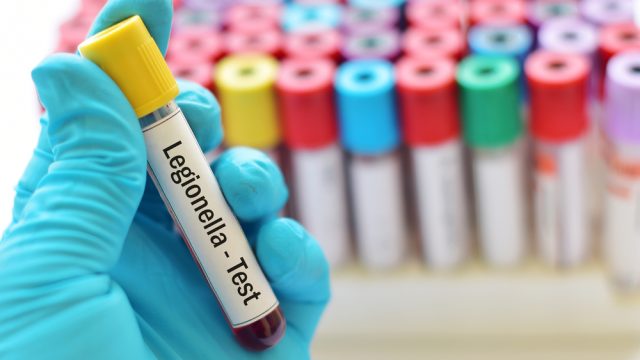 A close up of a gloved hand holding a Legionella blood test in a tube