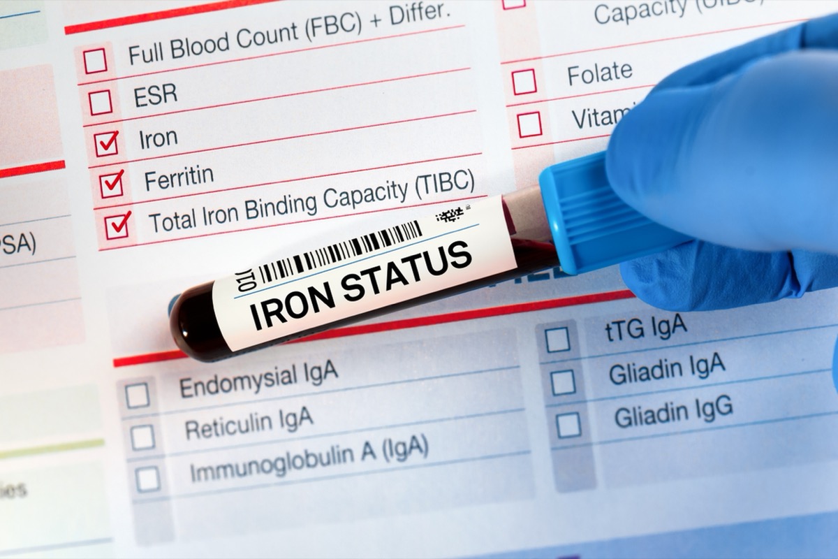 Blood sample tube for analysis of Iron Status Tests