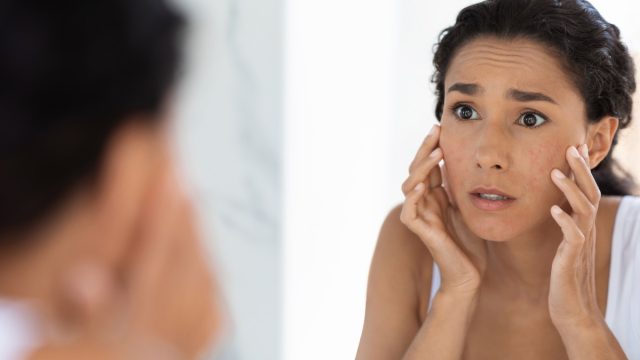Atopic Skin Concept. Worried Young Woman Looking At Mirror And Touching Face, Unhappy Millennial Lady Suffering Dermatitis, Examining Irritation Signs While Standing In Bathroom At Home, Closeup