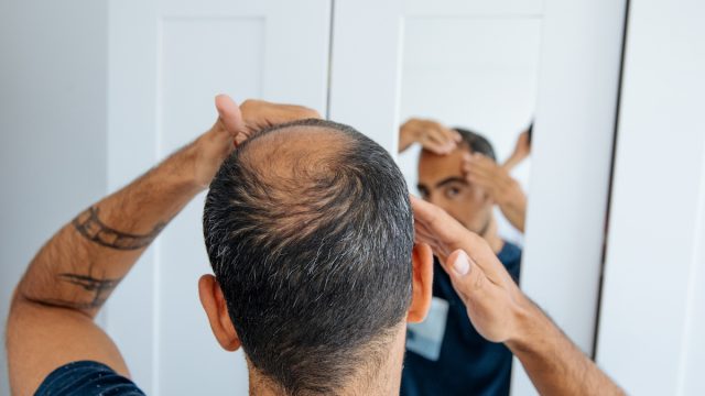 Man looking at bald spot in mirror