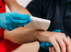 nurse putting gauze on a patient's hand with a snake bite