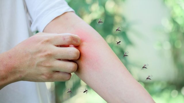 7 Reasons Mosquitoes Love You—And Not Everyone Else—Science Says