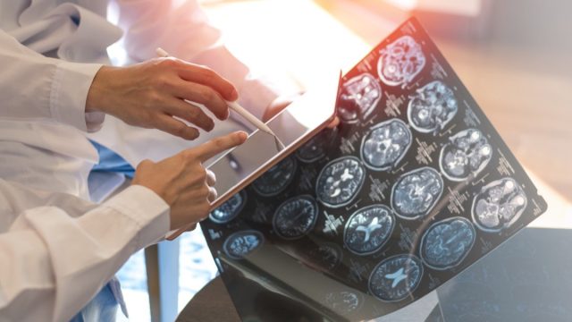 Scientists Say They Can Predict How Long You'll Live From a Single MRI